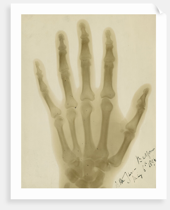 X-ray photograph of the hand of Arthur James Balfour by Alan Archibald Campbell Swinton