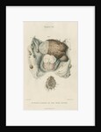 'Fungous tumour of the dura mater' by J Wedgewood