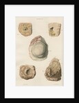 'Abscess of the brain' by J Stewart senior