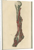 Dissection of an arm on which the operation for the Aneurism had been performed by unknown