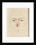A candidate for a nose replacement by Charles Turner