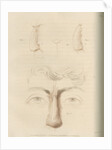 A successful nose replacement using the Indian Method by Charles Turner