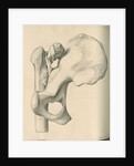 Posterior view of a left dislocated femur and hip bone by J Perry