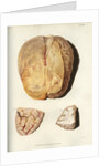 'Effects of jaundice on the brain and its membranes' by William Thomas Fry