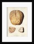 'Effects of jaundice on the brain and its membranes' by William Thomas Fry