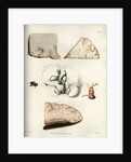 'Congestion in the minute vessels of the brain' by William Thomas Fry