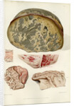 Parts of the brain including the dura mater by William Say