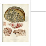 Parts of the brain including the dura mater by William Say