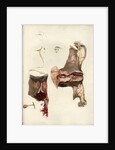 'Diseases of the uterus giving rise to excessive nervous irritation' by C J Canton
