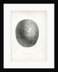 'Epilepsy' by Godefroy Engelmann