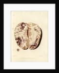 'Extravasion in the brain from obstructed circulation' by William Say