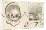Human bladder and bladder stones by Elizabeth Blackwell