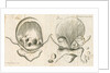 Human bladder and bladder stones by Elizabeth Blackwell