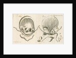 Human bladder and bladder stones by Elizabeth Blackwell