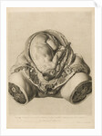 Foetus in the womb by Robert Strange