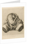 Foetus in the womb by Robert Strange