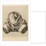 Foetus in the womb by Robert Strange
