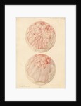 Superficial sore on a human leg by Franz Andreas Bauer
