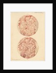 Superficial sore on a human leg by Franz Andreas Bauer