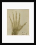 X-ray photograph of the hand of Robert Arthur Talbot Gascoyne-Cecil by Alan Archibald Campbell Swinton