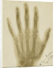 X-ray photograph of the hand of Arthur James Balfour by Alan Archibald Campbell Swinton