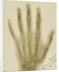 X-ray photograph of the hand of Arthur James Balfour by Alan Archibald Campbell Swinton