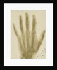 X-ray photograph of the hand of Arthur James Balfour by Alan Archibald Campbell Swinton