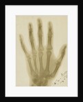 X-ray photograph of the hand of Arthur James Balfour by Alan Archibald Campbell Swinton