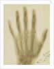 X-ray photograph of the hand of Arthur James Balfour by Alan Archibald Campbell Swinton