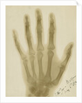 X-ray photograph of the hand of Arthur James Balfour by Alan Archibald Campbell Swinton