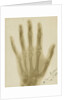 X-ray photograph of the hand of Arthur James Balfour by Alan Archibald Campbell Swinton