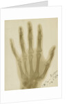 X-ray photograph of the hand of Arthur James Balfour by Alan Archibald Campbell Swinton