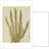 X-ray photograph of the hand of Arthur James Balfour by Alan Archibald Campbell Swinton