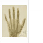 X-ray photograph of the hand of Arthur James Balfour by Alan Archibald Campbell Swinton