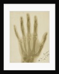 X-ray photograph of the hand of Arthur James Balfour by Alan Archibald Campbell Swinton