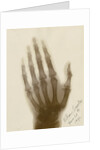 X-ray photograph of the hand of William Crookes by Alan Archibald Campbell Swinton