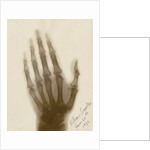X-ray photograph of the hand of William Crookes by Alan Archibald Campbell Swinton