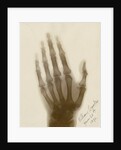X-ray photograph of the hand of William Crookes by Alan Archibald Campbell Swinton