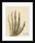 X-ray photograph of the hand of William George Armstrong by Alan Archibald Campbell Swinton