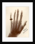 X-ray photograph of the hand of William Thomson by Alan Archibald Campbell Swinton