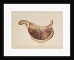 Effect of diphtheric-cholera on the mucous membrane of the stomach by d'Harlingue