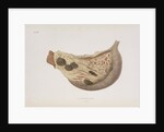 The stomach of a victim of cholera by d'Harlingue
