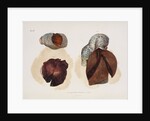 Changes in lung tissue occurring in cases of cholera by d'Harlingue