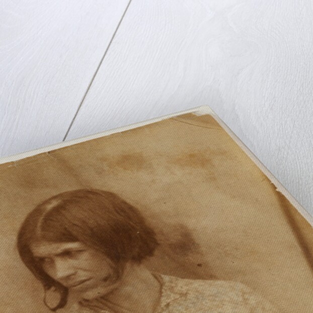 Portrait of a Patient, Surrey County Asylum by Hugh Welch Diamond