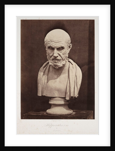 Hippocrates by Roger Fenton