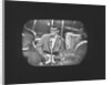 Buddy Holly on the Sunday Night at the Palladium TV show by Harry Hammond