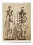 Skeletons by Roger Fenton
